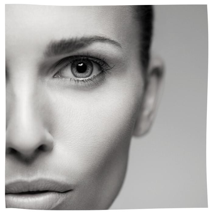 Eyelid (Blepharoplasty) Before & After eyelid surgery in scarsdale