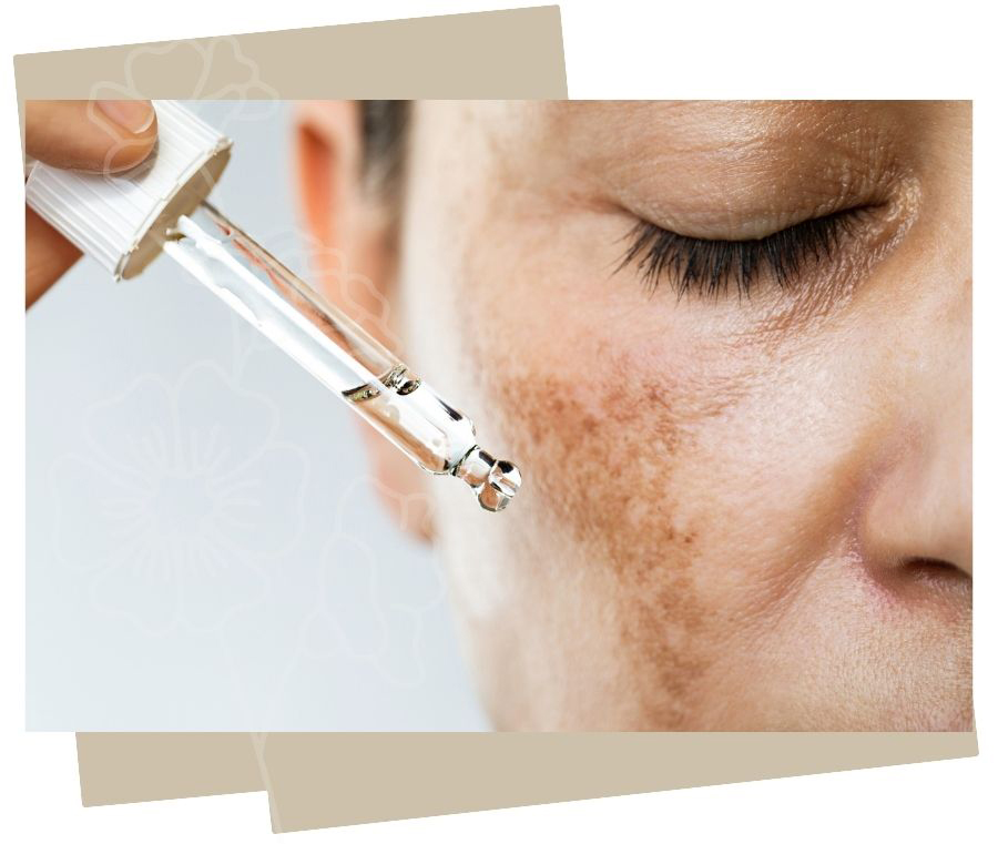 solutions for skin pigmentation scarsdale